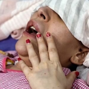 Iran’s Hospital Crisis: Civilians Speak Out After Airstrikes - Thumbnail