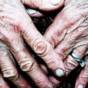 Early Detection of Parkinson’s Disease with Skin Swabs - Thumbnail
