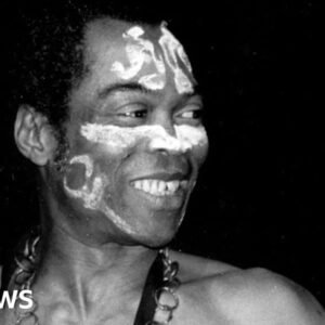 Cher Celebrates Milestone: First African to Receive Grammy’s Honor - Thumbnail