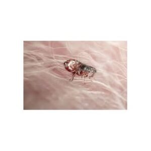 Rising Flea-Borne Typhus Cases in LA Raise Health Concerns - Thumbnail