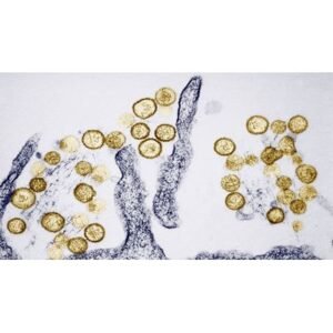 Shocking Outbreak: Three Lives Lost to Cruise Virus on MV Hondius - Thumbnail